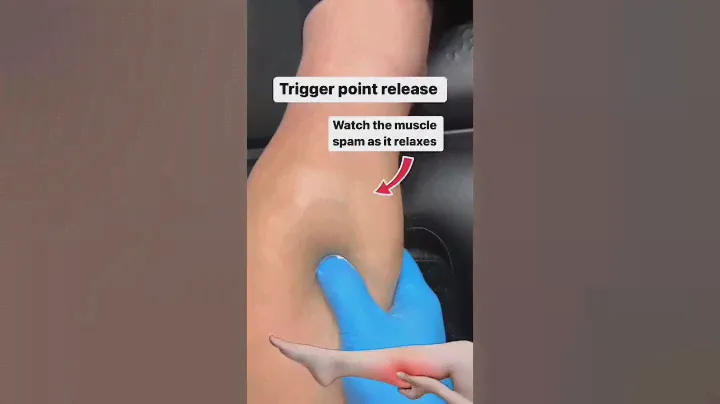 Trigger point release massage!!🥰(physio_mike)