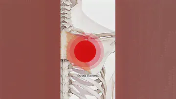 The Rhomboids Trigger Points